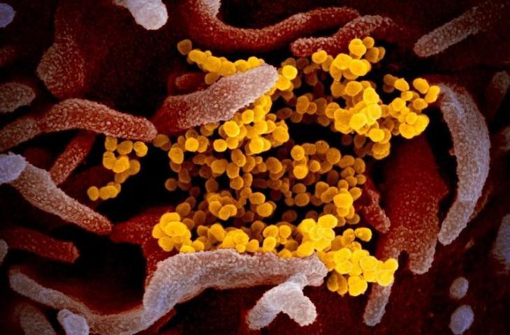 Wujud Virus COVID-19, Peyebab Pagbluk di Era Kekinian