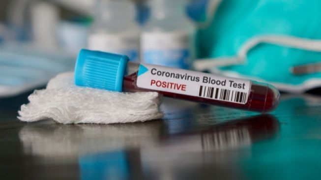 Coronavirus test reagen