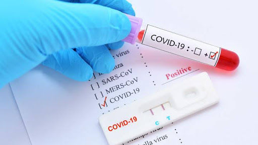 Sampel hasil rapid test Covid-19.