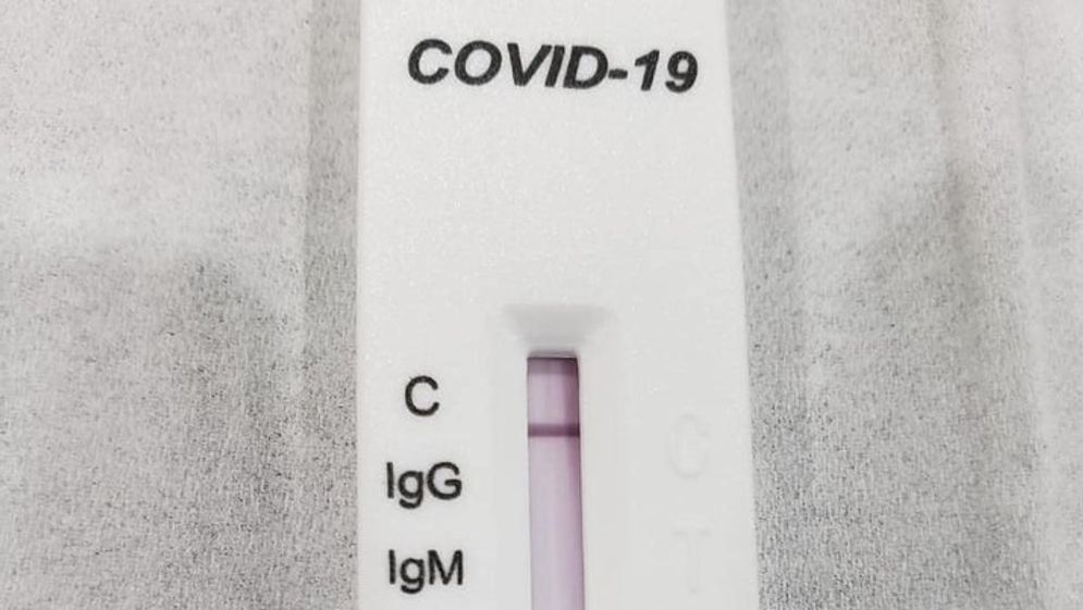Rapid Tes, Alat Screening COVID-19  Bukan Alat Diagnosis COVID-19