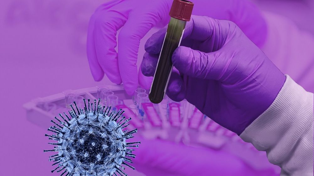 <p>Ilustrasi tes COVID-19. / Pixabay</p>