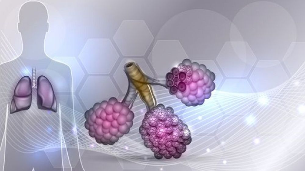 <p>Fibrosis paru-paru. / Shutterstock</p>
