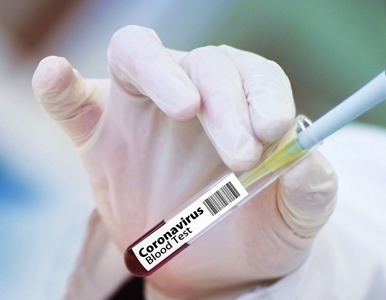 <p>Ilustrasi tes darah virus corona (COVID-19). / Pixabay</p>
