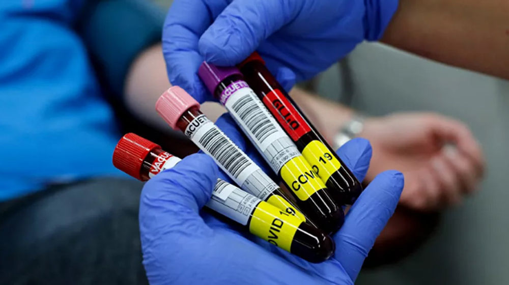 <p>Foto: Sputnik</p>
