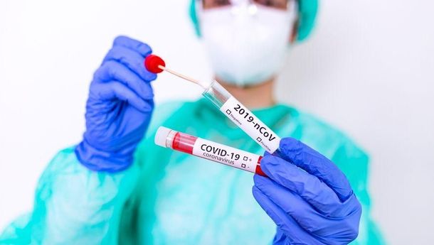 Berikut Harga Tertinggi Rapid Test Antigen Swab Sesuai Kesepakatan Pemerintah