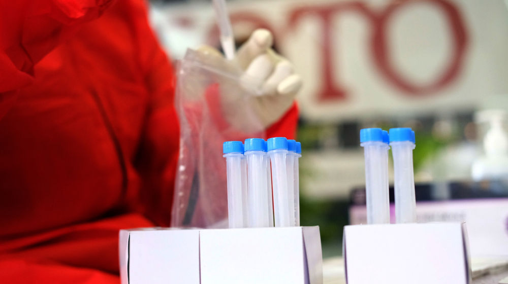 <p>Tenaga kesehatan menyimpan sampel tes usap antigen COVID-19 terhadap pewarta foto di Sekretariat Pewarta Foto Indonesia (PFI) Pusat, di kawasan Ampera, Jakarta, Minggu, 14 Februari 2021. Foto: Ismail Pohan/TrenAsia</p>
