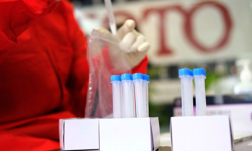 <p>Tenaga kesehatan menyimpan sampel tes usap antigen COVID-19 terhadap pewarta foto di Sekretariat Pewarta Foto Indonesia (PFI) Pusat, di kawasan Ampera, Jakarta, Minggu, 14 Februari 2021. Foto: Ismail Pohan/TrenAsia</p>
