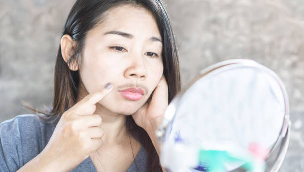 Tak Perlu Heran, Ini Alasan Ilimiah Kenapa Wanita Bisa Berkumis