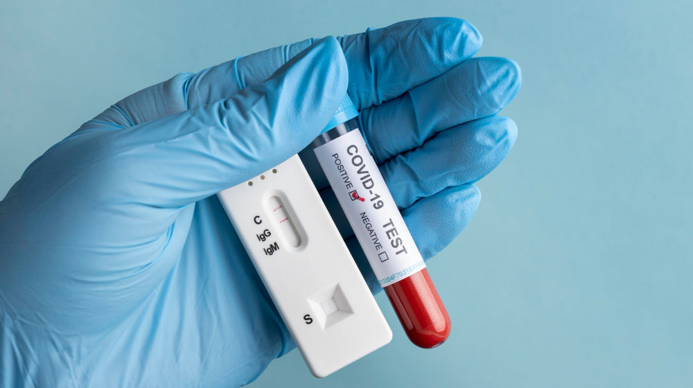 hInilah hal pertama yang harus dilakukan saat Anda positif COVID-19 tanpa gejalaand-with-protective-gloves-holding-blood-sample-covid-test.jpg