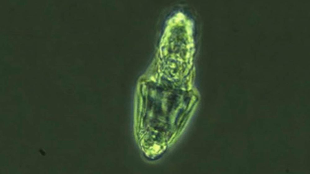<p>Rotifer yang pulih dari matin surinya setelah selama seminggu di lab/Foto: Live Science.</p>

