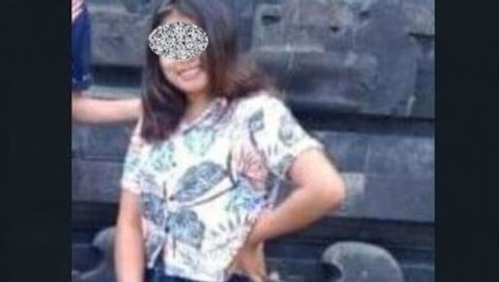 Mulai Terungkap, Epilepsi Diduga jadi Sebab Kematian Nona Kristina Deu Ngai di Kuta Bali