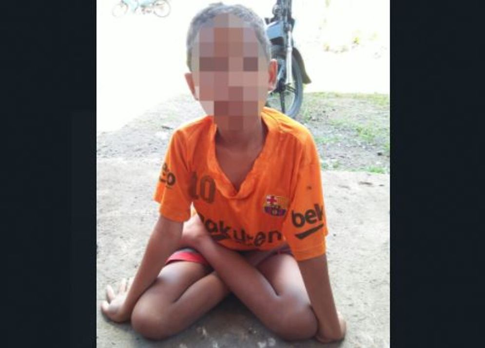 Ary, Bocah Penyandang Cacat di Kampung Jengok, Manggarai Timur 