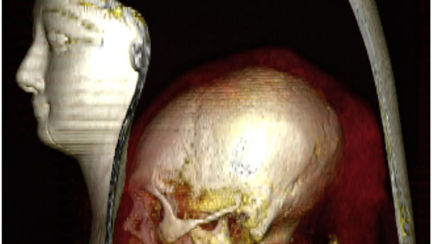 Mumi Firaun Berhasil Diungkap dengan Teknologi CT Scan