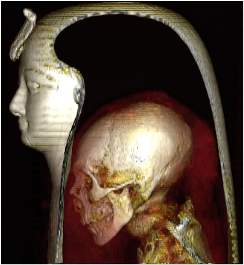 Para ilmuwan di Mesir menggunakan pemindai tomografi terkomputasi (CT Scan) untuk “mengupas” mumi Firaun Amenhotep I di Mesir yang berusia 3.500 tahun. 