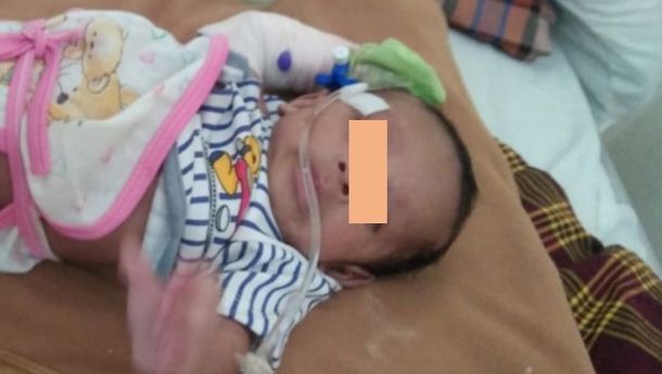 Bayi Usia 6 Bulan di Labuan Bajo Ini Mengidap Penyakit Bronkitis Sejak Lahir,  Butuh Uluran Tangan