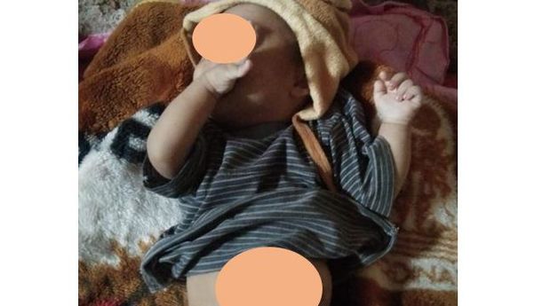 Terlahir Tanpa Lubang Anus, Bayi di Rahong Utara Ini Butuh Biaya untuk Segera Dioperasi