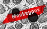 WHO akan mengubah nama virus Monkeypox demi menghindari sentimen negatif terhadap satu suku tertentu.
