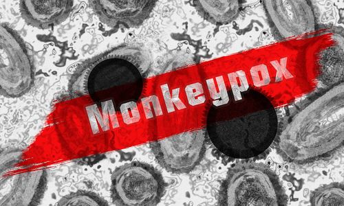 WHO akan mengubah nama virus Monkeypox demi menghindari sentimen negatif terhadap satu suku tertentu.