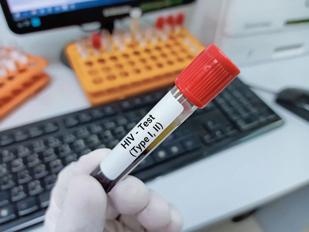 hiv.jpg