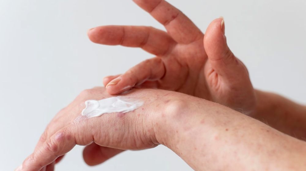 Makin Pintar! Google Lens Kini Mampu Deteksi Kondisi Kulit Anda