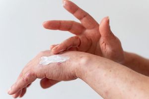 Makin Pintar! Google Lens Kini Mampu Deteksi Kondisi Kulit Anda