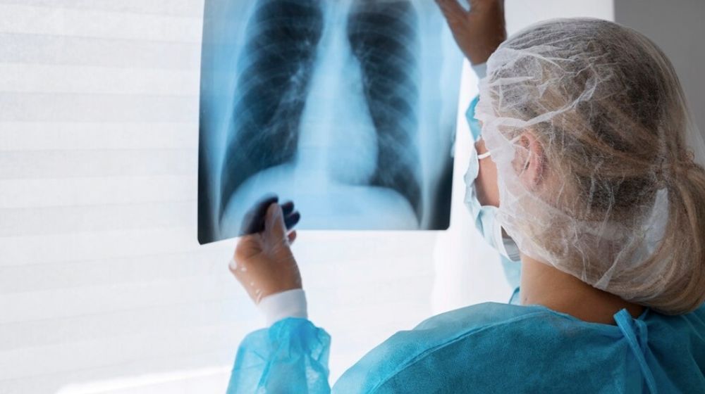 Ilustrasi tuberkulosis