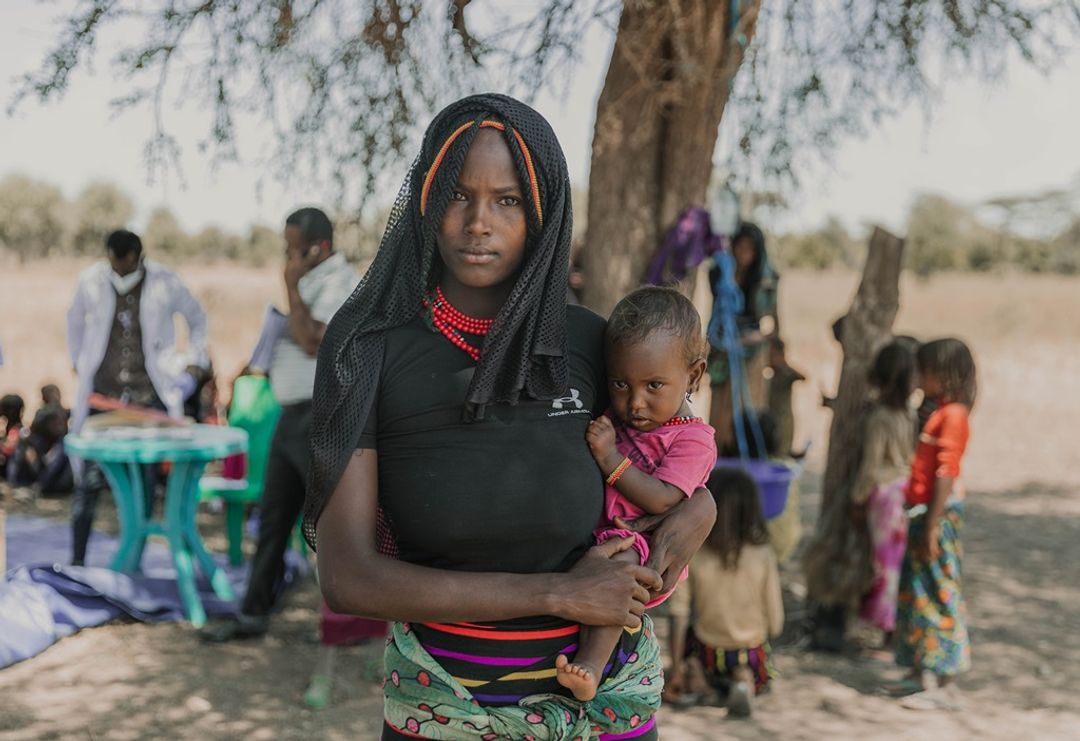 Malnutrisi di Ethiopia