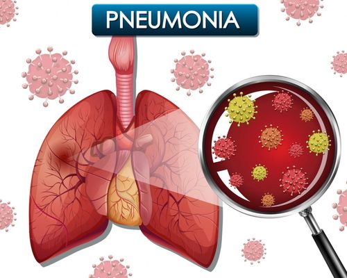 Adanya Laporan Pneumonia di China, Kemenkes Minta Semua Jajaran Kesehatan Siaga