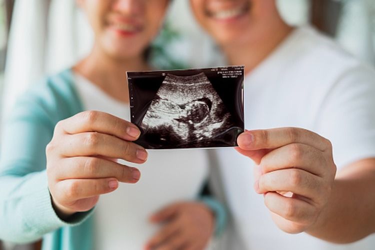 Tahun Shio Naga diburu pasangan untuk bisa mendapatkan bayi. 
