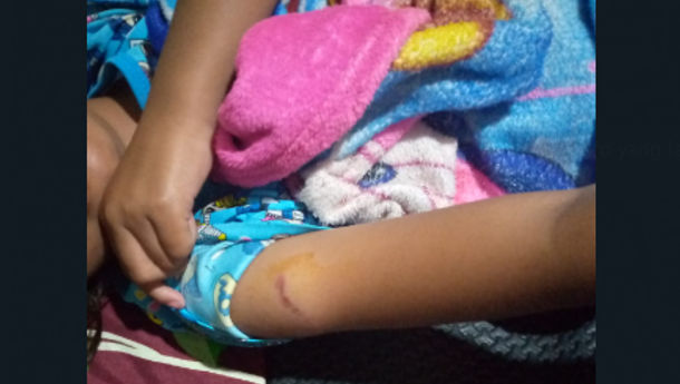 Warga Maumere, Kabupaten Sikka  Mengeluh Sulit Mendapatkan  Vaksin Rabies