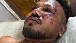Mukjizat di kursi 11A: Warga Negara Inggris Selamat dari Kecelakaan Pesawat Air India
