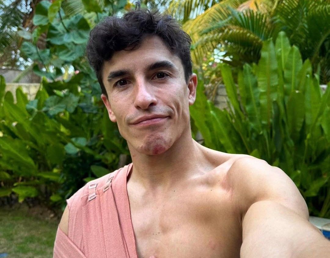 Marc Marquez memasang foto dengan lengan diperban. Minta fans tak kasari Marco Bezzechi. (IG @marcmarquez93)