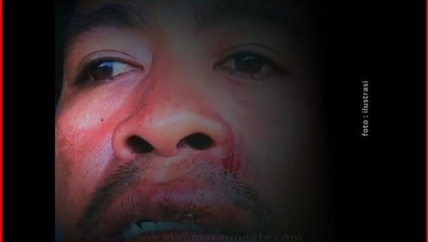 Hoaks, Kabar Guru Dipukul Saat Rapat di Dinas PKO Sikka 